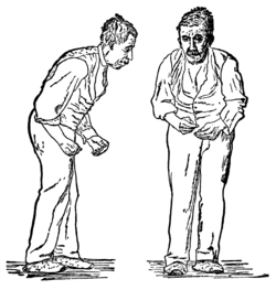 兩幅插畫分別由前面和右側描繪了同個男人，可見他面無表情、彎腰駝背、舉步維艱。